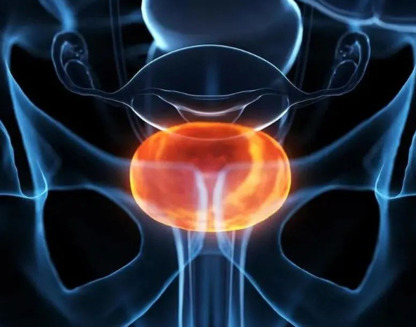 男性泌尿道感染对生殖健康有什么影响？如何避免并发症的发生？