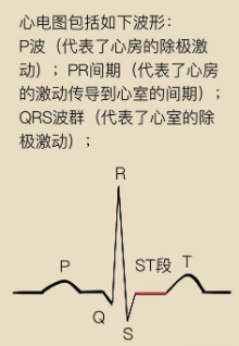 心电图ST-T改变，除了心梗的其他原因