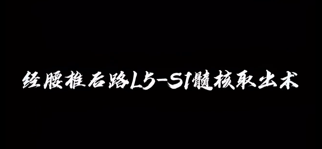 经腰推后路L5-S1髓核取出术【官方编号：1241265678577664】